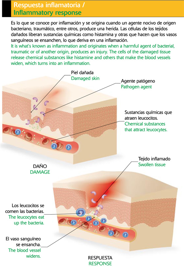 Respuesta inflamatoria